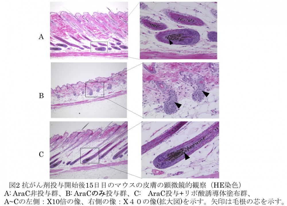 抗がん剤AraCによる発毛抑制効果に対するαリポ酸誘導体の効果の画像1