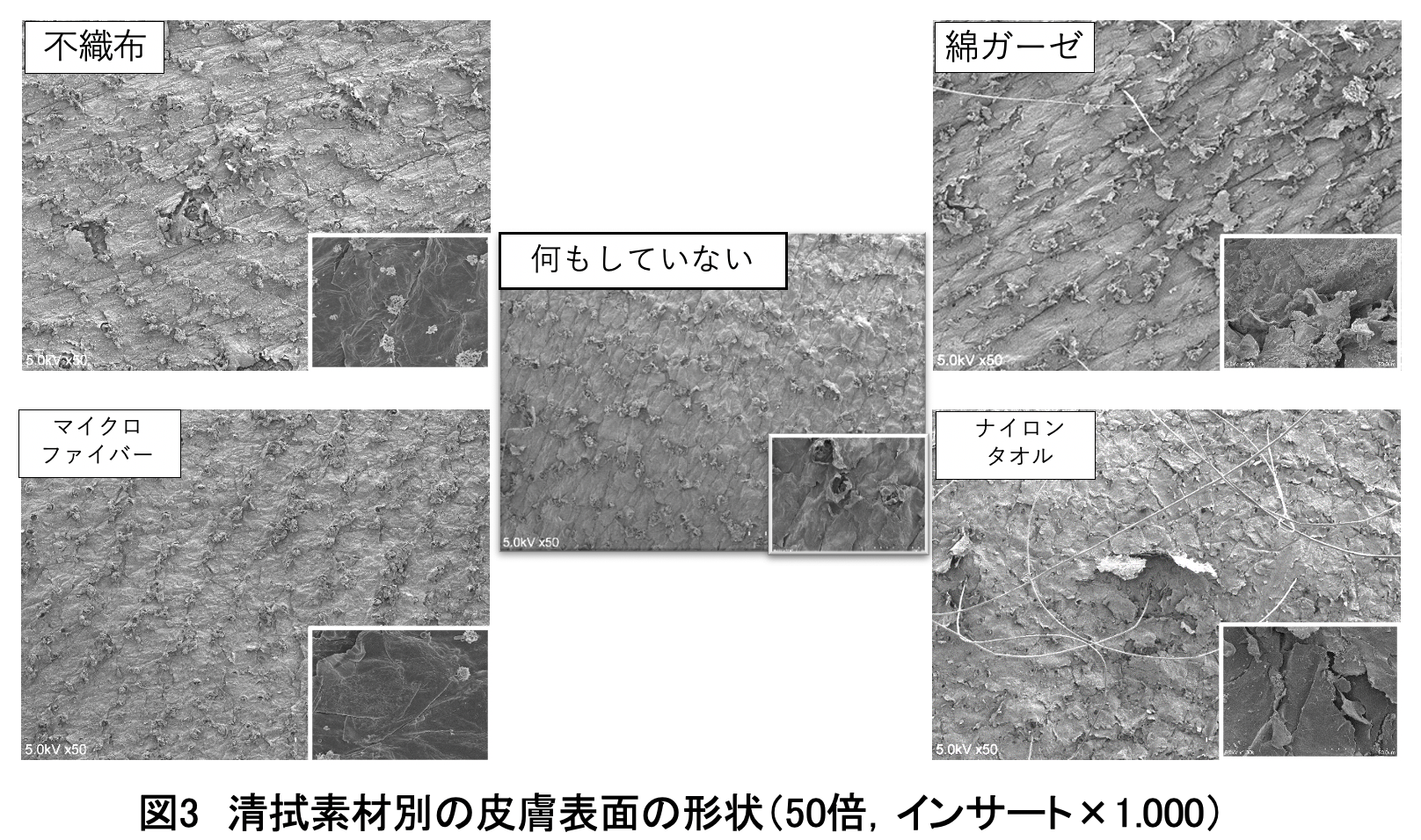 表皮表面の形状